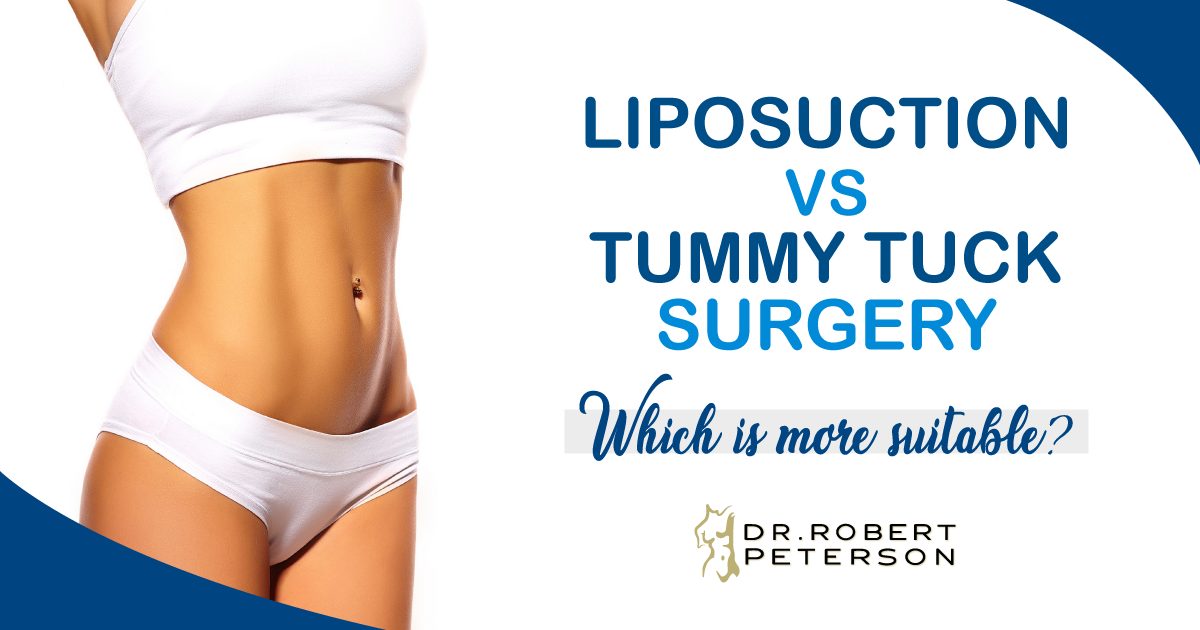 Dr. Trussler Liposuction Surgeon Austin
