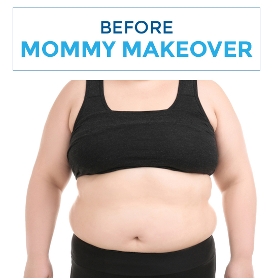 Before-mommy
