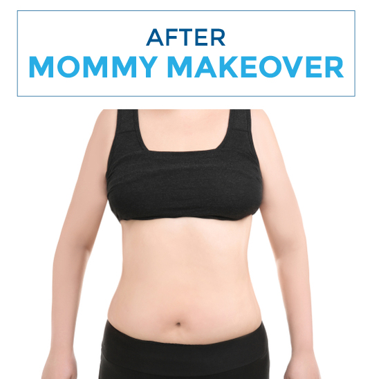 After-mommy