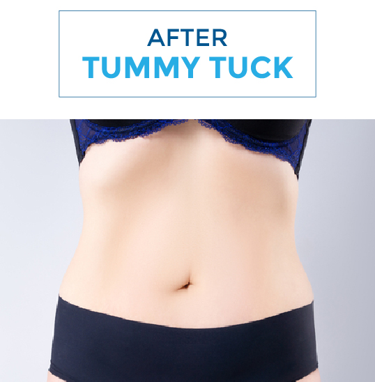 After-tummy